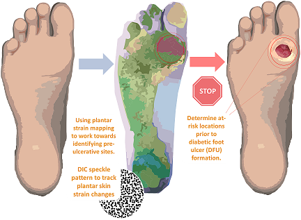 Diabetic Foot risk assessment pathway for strain analysis