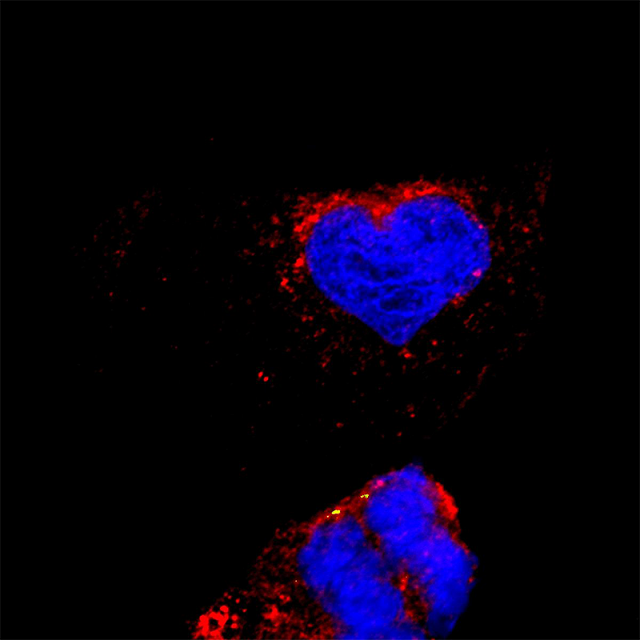 A scientific image of a heart of the cell.