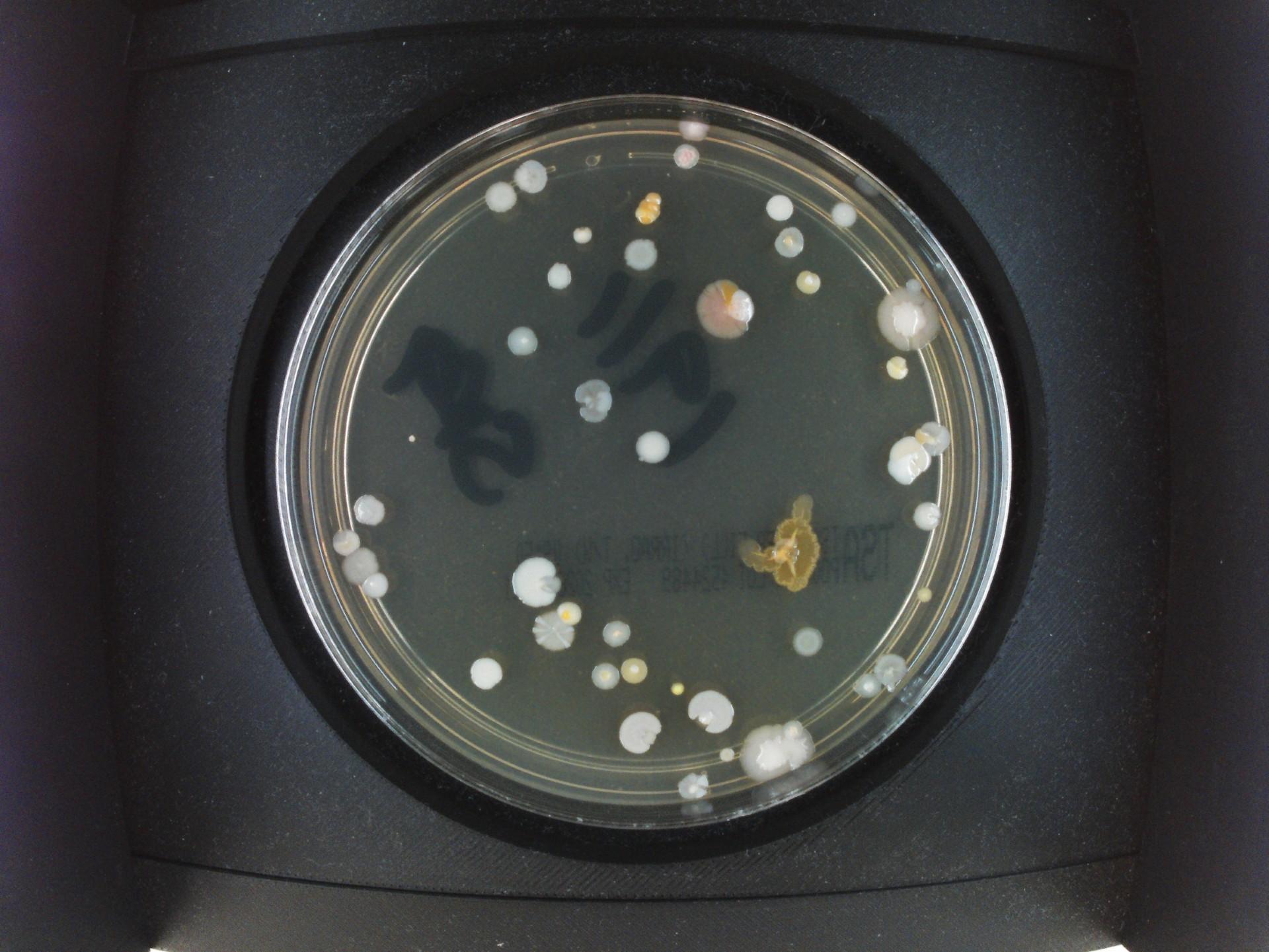 Petri dish with multiple small microbial colonies on agar, viewed from above.