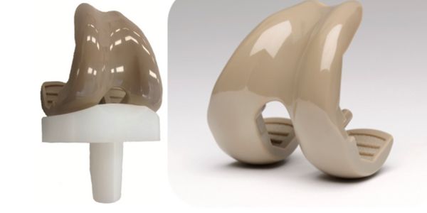 PEEK-OPTIMA as a Platform for Natural Total Knee Replacement