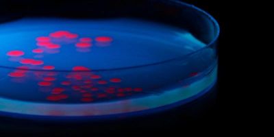 A petri dish containing a growth medium on which Escherichia coli (E.coli) is growing.