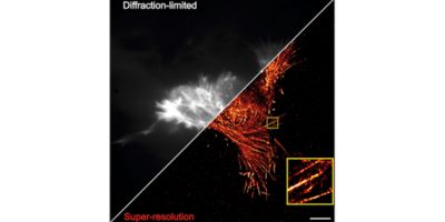 Mpn seminar cover image