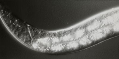 Microscope image of a nematode worm.