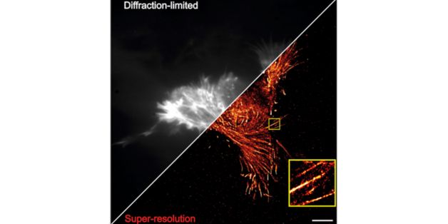 Mpn seminar cover image