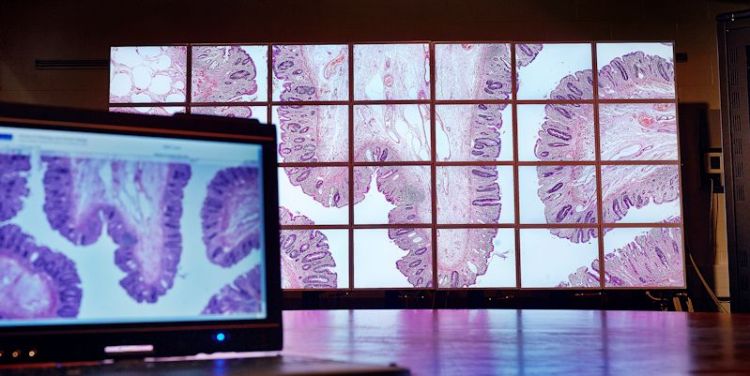 Researchers in the School of Computing win best paper award for work on digital pathology