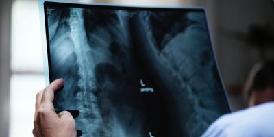 AI-powered X-ray diagnosis technology awarded funding